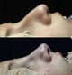 Slider image (10) Dr. Juan Sanabria Plastic Surgeon